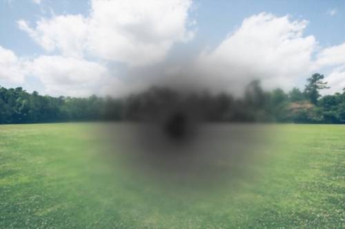 Degeneración Macular relacionada a la edad (DMRE)